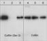 Cofilin 1 antibody, CP1151, ECM Biosciences, Western Blot image 