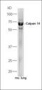 Megakaryocyte And Platelet Inhibitory Receptor G6b antibody, orb156121, Biorbyt, Western Blot image 