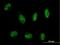 Myotubularin Related Protein 8 antibody, H00055613-B01P, Novus Biologicals, Immunofluorescence image 