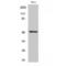 Protein Kinase, Membrane Associated Tyrosine/Threonine 1 antibody, LS-C384736, Lifespan Biosciences, Western Blot image 