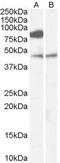 Zinc Finger DHHC-Type Containing 8 antibody, GTX89139, GeneTex, Western Blot image 