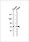 Collagen Type VIII Alpha 1 Chain antibody, GTX53499, GeneTex, Western Blot image 