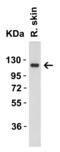Angiotensin I Converting Enzyme 2 antibody, A00756, Boster Biological Technology, Western Blot image 