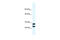 Annexin A13 antibody, 28-524, ProSci, Enzyme Linked Immunosorbent Assay image 