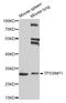 Tumor Protein P53 Inducible Nuclear Protein 1 antibody, STJ110573, St John