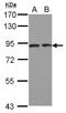 Discoidin, CUB And LCCL Domain Containing 2 antibody, LS-C155280, Lifespan Biosciences, Western Blot image 