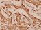 GRB2 Associated Binding Protein 1 antibody, A01989-2, Boster Biological Technology, Immunohistochemistry paraffin image 