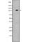 PMS1 Homolog 1, Mismatch Repair System Component antibody, abx146853, Abbexa, Western Blot image 