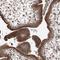 Zinc Finger Protein 25 antibody, HPA030190, Atlas Antibodies, Immunohistochemistry paraffin image 