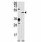 Sirtuin 7 antibody, F49523-0.4ML, NSJ Bioreagents, Western Blot image 