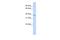 Transmembrane Protein 82 antibody, A18651, Boster Biological Technology, Western Blot image 