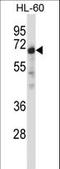 Nuclear Receptor Binding Protein 1 antibody, LS-C163008, Lifespan Biosciences, Western Blot image 