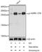 Heat Shock Protein Family B (Small) Member 1 antibody, AE00231, Aeonian Biotech, Western Blot image 