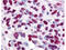GLI Family Zinc Finger 3 antibody, A01171, Boster Biological Technology, Immunohistochemistry paraffin image 