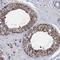 Translocase Of Inner Mitochondrial Membrane 10 antibody, NBP1-80682, Novus Biologicals, Immunohistochemistry paraffin image 