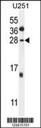 Gamma-Glutamyltransferase Light Chain 2 antibody, 55-092, ProSci, Western Blot image 