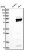 H2.0 Like Homeobox antibody, HPA005968, Atlas Antibodies, Western Blot image 