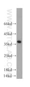 ATP Synthase Mitochondrial F1 Complex Assembly Factor 1 antibody, 18016-1-AP, Proteintech Group, Western Blot image 