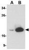 Lymphocyte Antigen 96 antibody, GTX85122, GeneTex, Western Blot image 