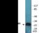 Troponin I3, Cardiac Type antibody, EKC2130, Boster Biological Technology, Western Blot image 