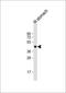 Ghrelin O-acyltransferase antibody, GTX53651, GeneTex, Western Blot image 