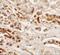 NK2 Homeobox 2 antibody, A04740, Boster Biological Technology, Immunohistochemistry paraffin image 