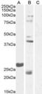 Fibroblast Growth Factor 23 antibody, NBP2-27553, Novus Biologicals, Western Blot image 