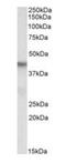 PIN2 (TERF1) Interacting Telomerase Inhibitor 1 antibody, orb20430, Biorbyt, Western Blot image 