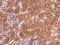 Calcium/calmodulin-dependent protein kinase type 1 antibody, GTX106082, GeneTex, Immunohistochemistry paraffin image 