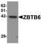 Zinc Finger And BTB Domain Containing 6 antibody, orb95585, Biorbyt, Western Blot image 