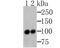 MutS Homolog 2 antibody, NBP2-76896, Novus Biologicals, Western Blot image 