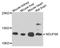 NADH:Ubiquinone Oxidoreductase Subunit S6 antibody, A3985, ABclonal Technology, Western Blot image 