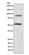 Doublecortin Like Kinase 1 antibody, M03089, Boster Biological Technology, Western Blot image 