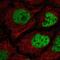 Chromosome 2 Open Reading Frame 49 antibody, NBP2-56365, Novus Biologicals, Immunofluorescence image 