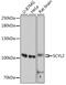 SCY1 Like Pseudokinase 2 antibody, GTX66175, GeneTex, Western Blot image 