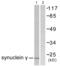 SNCG antibody, abx013200, Abbexa, Western Blot image 