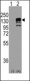 Cadherin 1 antibody, 57-982, ProSci, Western Blot image 