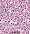 Alkaline Phosphatase, Placental antibody, abx027463, Abbexa, Immunohistochemistry frozen image 