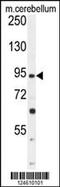 Gamma-Aminobutyric Acid Type B Receptor Subunit 2 antibody, MBS9212541, MyBioSource, Western Blot image 