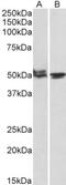 MON1 Homolog A, Secretory Trafficking Associated antibody, NBP1-52007, Novus Biologicals, Western Blot image 
