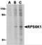 Ribosomal Protein S6 Kinase A1 antibody, 3511, ProSci, Western Blot image 