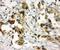 Catechol-O-Methyltransferase antibody, PA2203, Boster Biological Technology, Immunohistochemistry paraffin image 