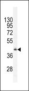 Regulator Of Microtubule Dynamics 1 antibody, PA5-71594, Invitrogen Antibodies, Western Blot image 