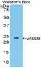 Interferon Beta 1 antibody, MBS2001888, MyBioSource, Western Blot image 