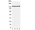 Zinc Finger E-Box Binding Homeobox 1 antibody, R31092, NSJ Bioreagents, Western Blot image 