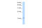 Small muscular protein antibody, 29-604, ProSci, Enzyme Linked Immunosorbent Assay image 