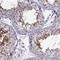 Serine Protease 37 antibody, NBP1-86430, Novus Biologicals, Immunohistochemistry paraffin image 