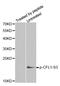 Cofilin 1 antibody, MBS128535, MyBioSource, Western Blot image 