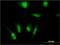 Transcription initiation factor TFIID subunit 7-like antibody, H00054457-M04, Novus Biologicals, Immunocytochemistry image 