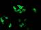 RAB37, Member RAS Oncogene Family antibody, MA5-26104, Invitrogen Antibodies, Immunocytochemistry image 